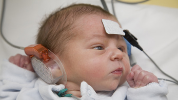 Nincsenek meg a gépek a kötelező újszülöttkori hallásszűréshez