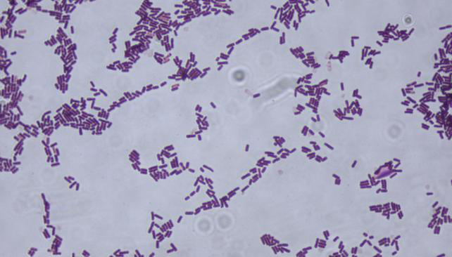 Bacillus subtilis Gram stain.0