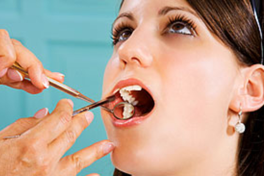 Fúrás és tömés nélkül kezelhető a fogszuvasodás