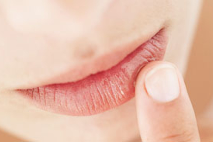 Szőlőzsírfüggőség: mitől alakul ki, és mit használj, hogy rendben legyen a szád?