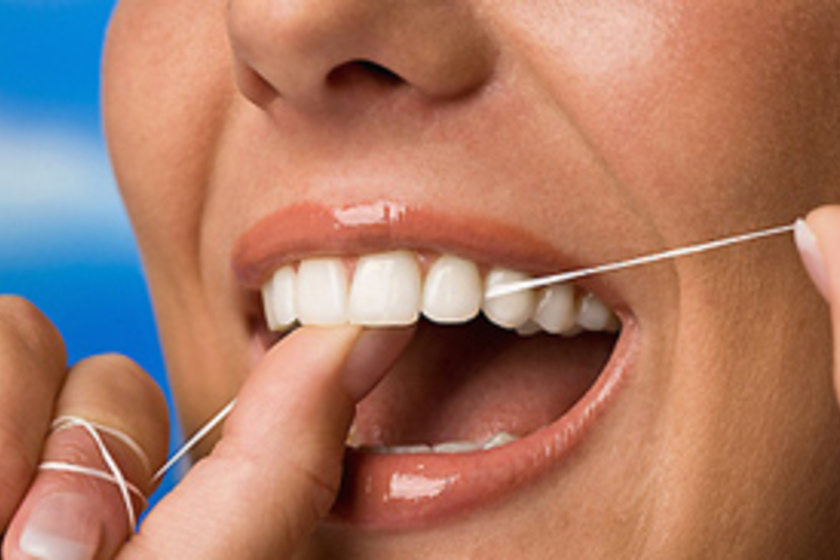 A 8 legjobb fogkőellenes tipp