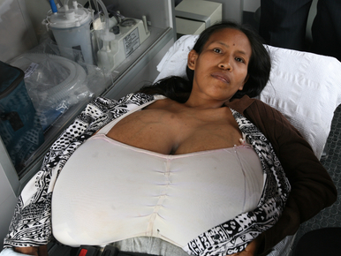 Hatalmas melle ágyhoz láncolt egy perui nőt