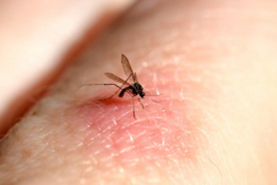 Ezt tedd az ágyad mellé, hogy békén hagyjanak a szúnyogok: képeken 5 szuper módszer