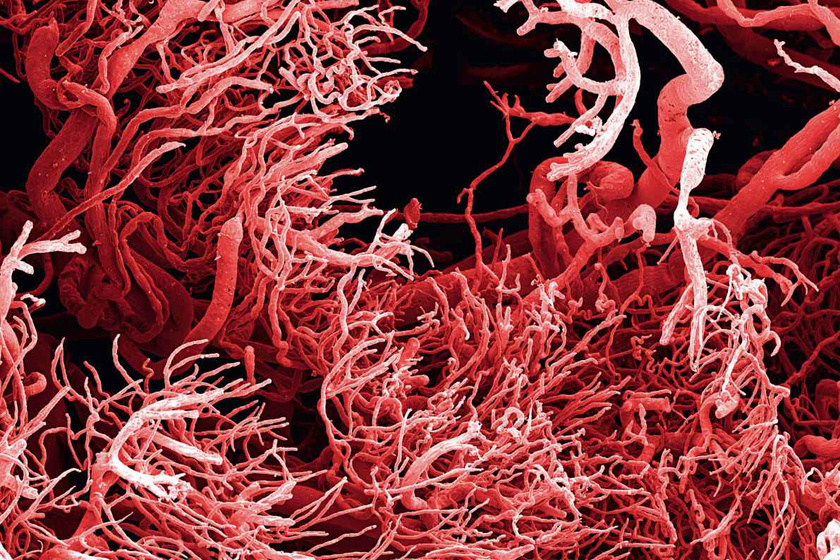 Így néz ki egy ráksejt milliószoros nagyításban: megdöbbentő képek az emberi testből