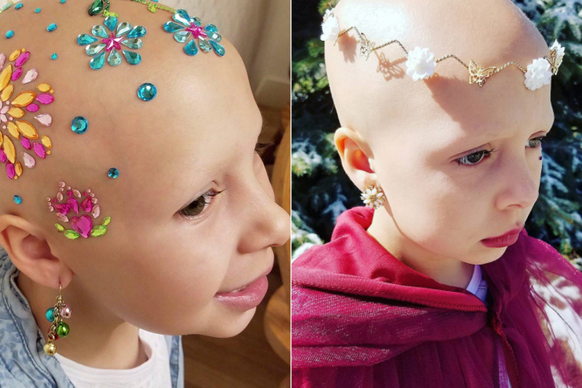 Bátorságból csillagos ötös: ez a kislány nagyon megindítót tett, miután kihullott a haja