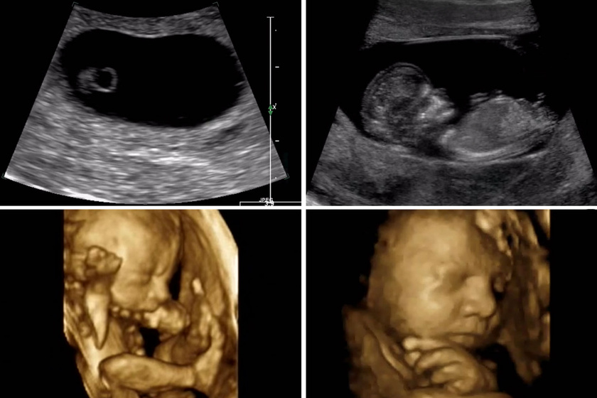 9 hónap 4 és fél perces videón: terhesség a megtermékenyítéstől a szülésig