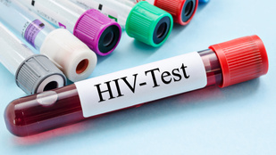 8 tévhit a HIV-fertőzésről (amit sokan még mindig tényként kezelnek)