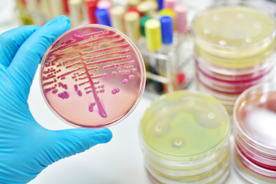 A legaktívabb baktériumtenyészet a lakásban: nem a vécé környékén kell keresni