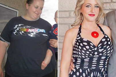Depresszióval és elhízással küzdött: 45 kilót adott le - Mutatjuk, milyen étrenddel