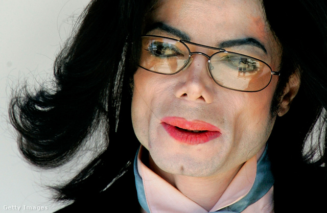 Michael Jackson a tankönyvi esete annak a lelki rendellenességnek, amelyet az angol nyelvű szakirodalom a Body Dysmorphic Disorder (BDD) kifejezéssel ír le. Ez azt jelenti, hogy valaki képtelen úgy nézni saját magára, ahogyan azt mások teszik. A pop 12 éve halott királyánál a fehérített bőr csak a kezdet volt, a véget pedig valószínűleg az állbeültetés jelentette.