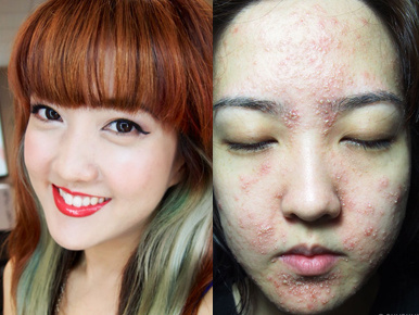 Horrorba illő lett a beauty blogger arca