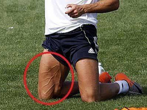 Hogy néz ki C. Ronaldo lába?