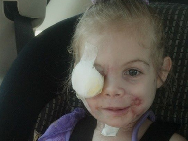 Undorító módon megaláztak egy sérült kislányt