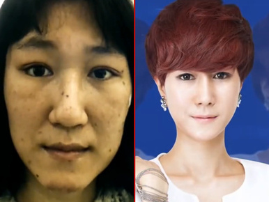 Így lett szépség a ronda koreai nőből