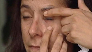 Ez a nő pillanatragasztót kapott a szemcsepp helyett, és összetapadt a szemhéja