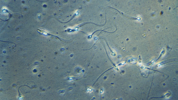 Működő spermát hoztak létre laborban kínai kutatók