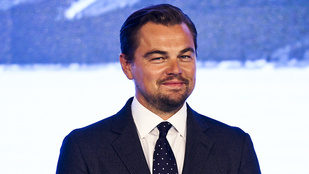Leonardo DiCaprio fején történt valami gyanús