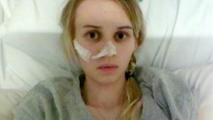 Kalóriák belélegzésétől retteg az anorexiával sújtott brit lány