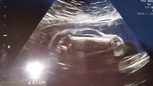 Saját nagymamája nézett vissza a terhes nőre az ultrahangról