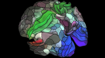 Száz új régiót találtak az emberi agyban