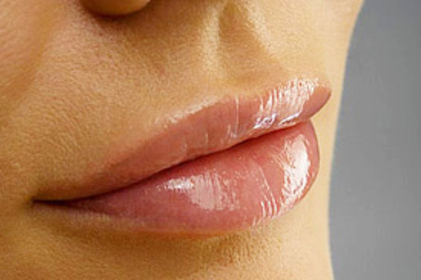 9 remek módszer cserepes ajkak ellen