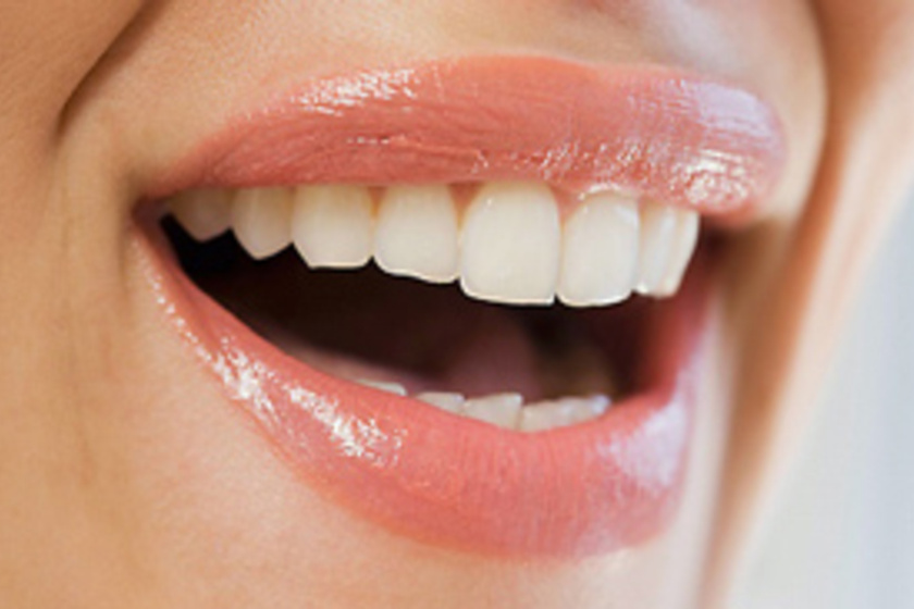 4 természetes gyógymód vérző íny és érzékeny fogak ellen 