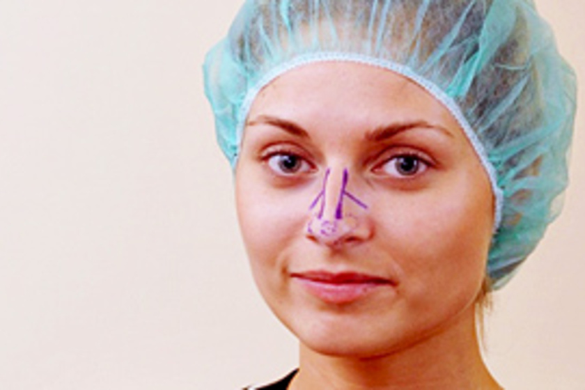 Plasztikai műtéten esett át Bálizs Anett, a TV2 népszerű színésznője