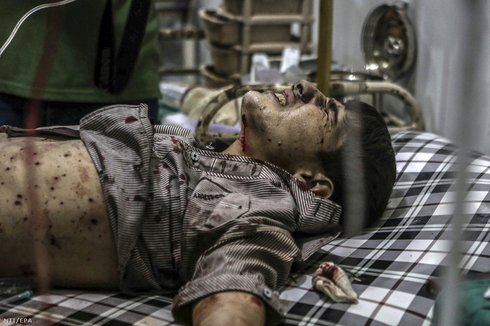 Sebesült szíriai fiú egy tábori kórházban, 2016. őszén.