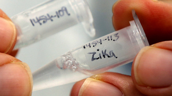 A zikavírus az újszülött agyában is képes szaporodni