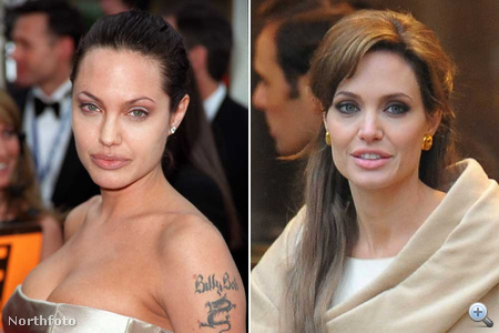 A 2010-es Angelina Jolie orra mintha vékonyabb lenne, mint régen, kevésbé lóg a szemhéja, és talán magasabbra került az arccsontja, ráadásul bőre ugyanolyan hibátlan, mint 10 éve.