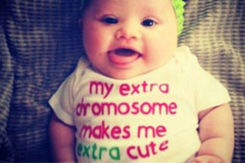 Amikor a gyerek plusz egy kromoszómával születik - A Down-kórról