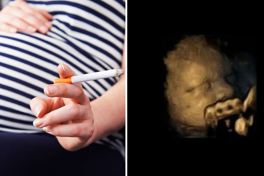 Döbbenetes ultrahangképek: így reagál a baba a méhben, ha rágyújt az anya
