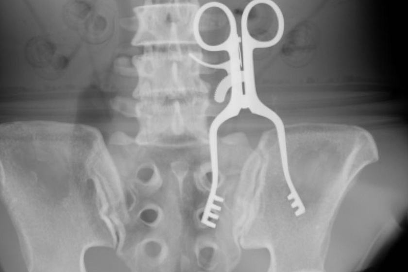 Emiatt bármelyik orvos szégyenkezne: 5 röntgen, amit szívesen letagadnának