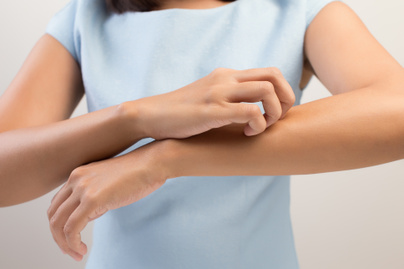 Így kezeld otthon a csúnya bőrbetegséget: 5 dolog, ami segít, hogy elmúljon 