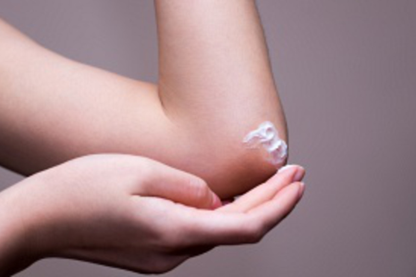 Az 3 legjobb házi krém ekcémás bőrre: csökkentik az irritációt, gyógyítják a bőrt