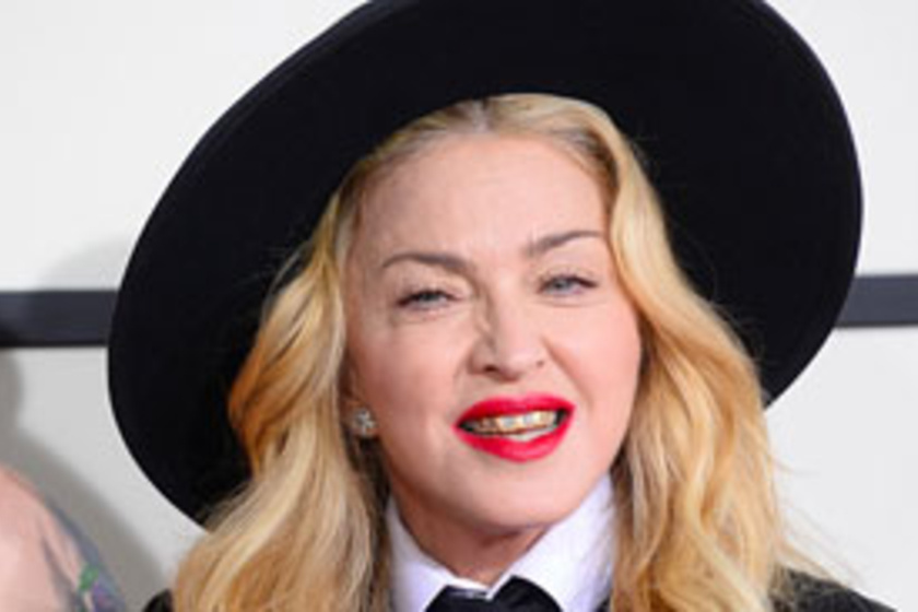 Madonna fejéből kiment a botox, és mennyivel jobban néz ki!