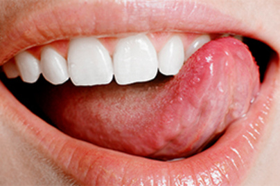 Hpv befolyásolja a szájat, Hol találkozhatunk HPV-vel?