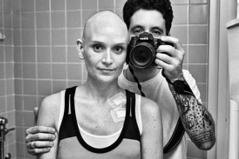 Mások elbújnak, ők bátran vállalták! 4 szívbemarkoló fotó a kemoterápia hatásáról