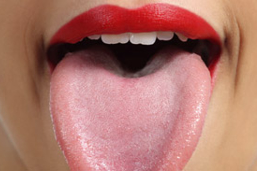 Hol van repedés a nyelveden? Erre a 7 betegségre utal