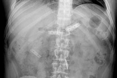 7 zavarba ejtő felvétel, amin a röntgenorvos is megdöbbent