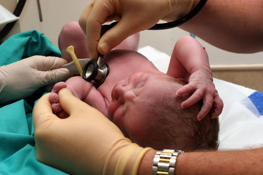 Ezt nem mutatta az ultrahang: csak pislogtak a szülőszobán, mikor a baba kibújt