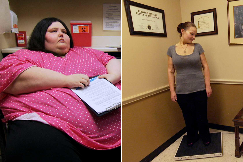 250 kilóról kezdte a fogyást: elképesztő változáson ment keresztül - Képeken a tényleg durva átalakulás