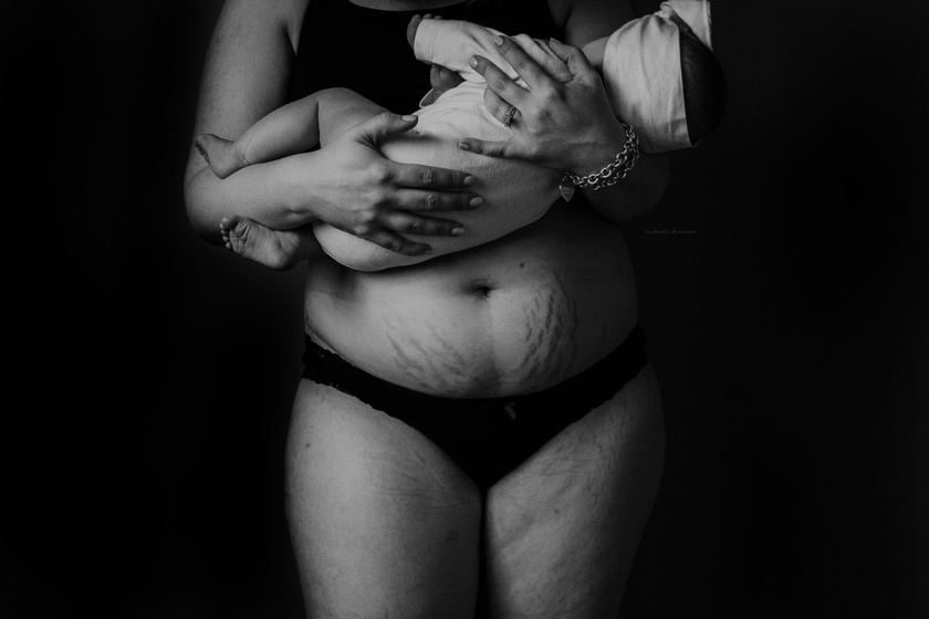 Megrendítően szép fotósorozat a szülés utáni pocakról, amit minden anyának látnia kell