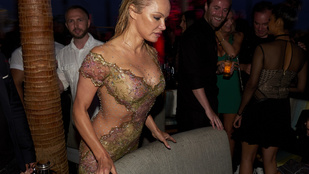 Pamela Anderson mellben erős hétvégéje sokkolóba váltott