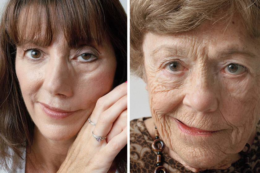 Máig látszik arcukon, de gyönyörűek: megrázó képeken a stroke-túlélők