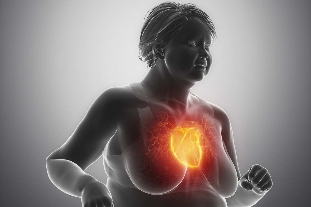 A gyors fogyás hatása a szívre: A fogyókúra hatással lehet a szívre? - unica2018.cz