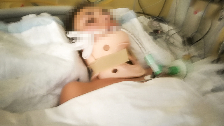 Autóbalesete óta kómában fekszik egy szegedi lány Bulgáriában