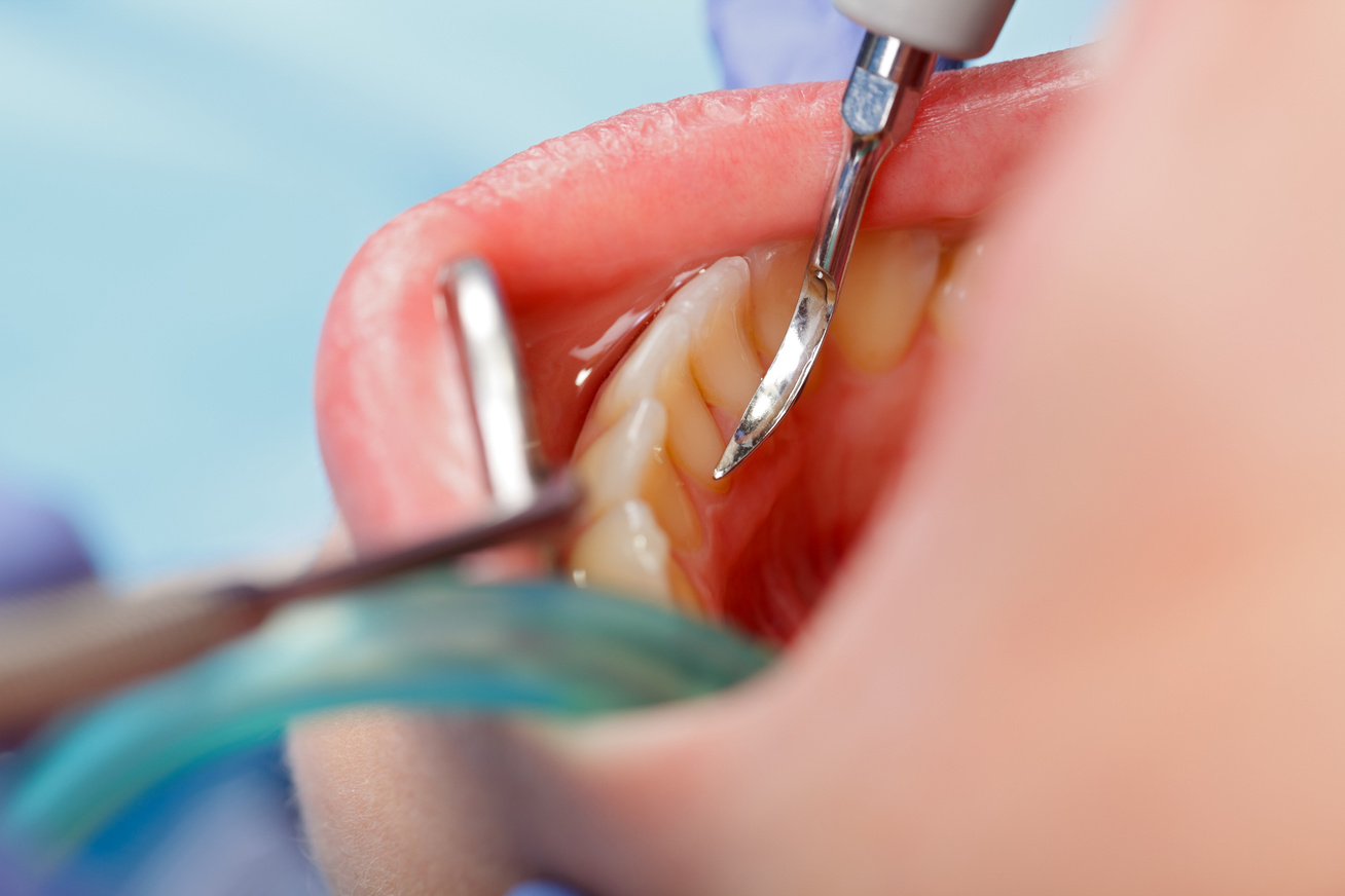 fogorvos-kezel