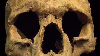 A világ legrégebbi leprás betegét találták meg Abonynál