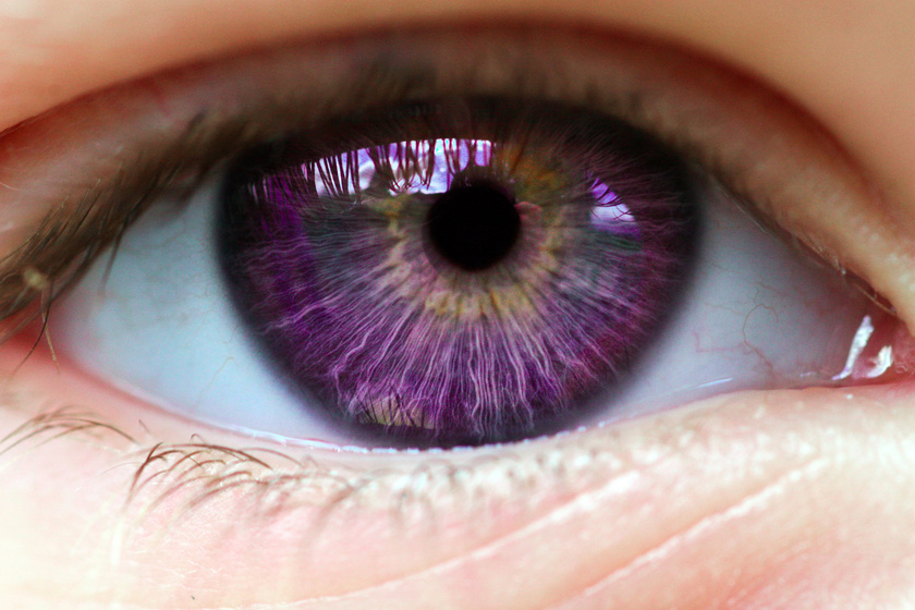 Ilyen gyönyörű szemet ritkán látni: 10 génhiba az emberen, ami valójában csodaszép